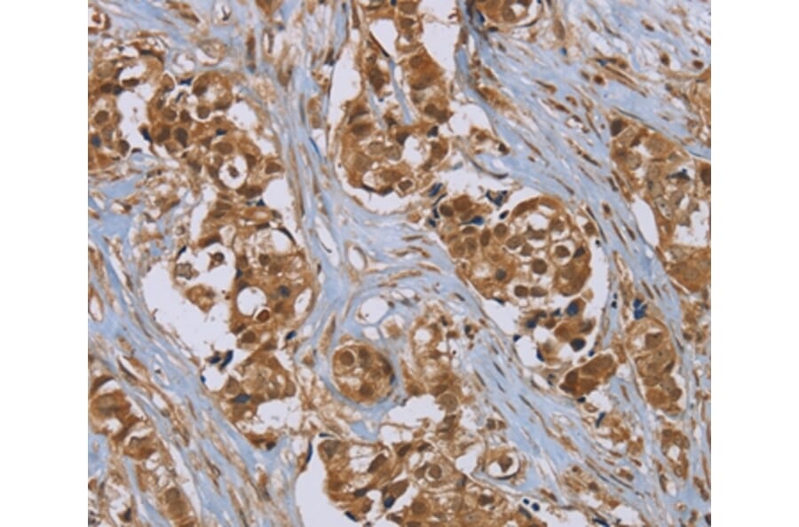 Immunohistochemistry - PUS10 Antibody from Signalway Antibody (37852) - Antibodies.com