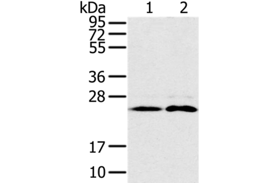 RAB14 Antibody from Signalway Antibody (37854) - Antibodies.com