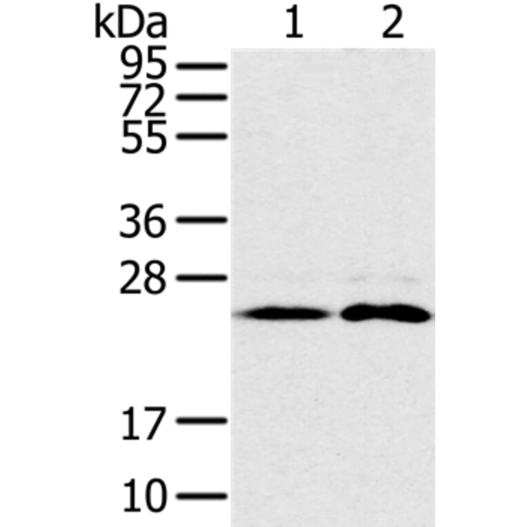 RAB14 Antibody from Signalway Antibody (37854) - Antibodies.com