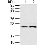 RAB14 Antibody from Signalway Antibody (37854) - Antibodies.com