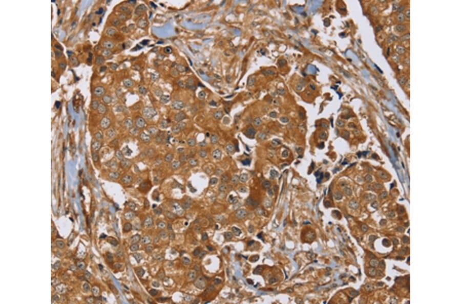 Immunohistochemistry - RAB14 Antibody from Signalway Antibody (37854) - Antibodies.com