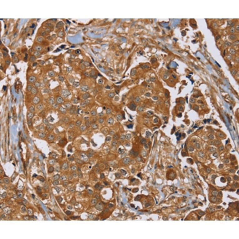 Immunohistochemistry - RAB14 Antibody from Signalway Antibody (37854) - Antibodies.com