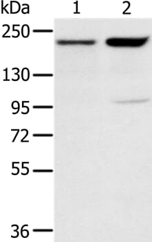 Gel: 6%SDS-PAGE Lysates (from left to right): 231 and hela cell Amount of lysate: 40ug per lane Primary antibody: 1/200 dilution Secondary antibody dilution: 1/8000 Exposure time: 2 minutes