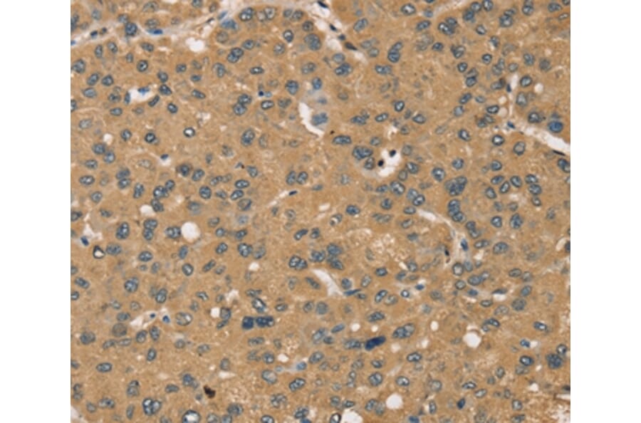 Immunohistochemistry - KDM5A Antibody from Signalway Antibody (37863) - Antibodies.com