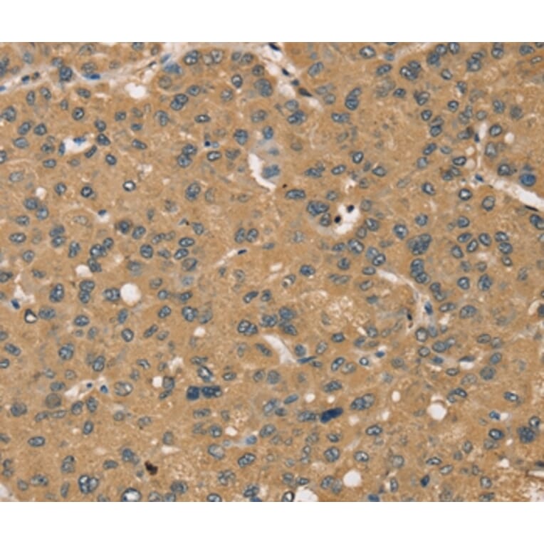 Immunohistochemistry - KDM5A Antibody from Signalway Antibody (37863) - Antibodies.com