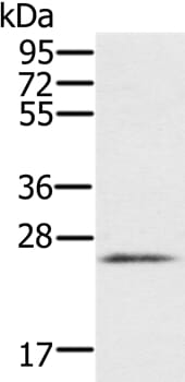 Gel: 10% SDS-PAGE Lysates (from left to right): Human heart tissue Amount of lysate: 40ug per lane Primary antibody: 1/200 dilution Secondary antibody dilution: 1/8000 Exposure time: 1 minute