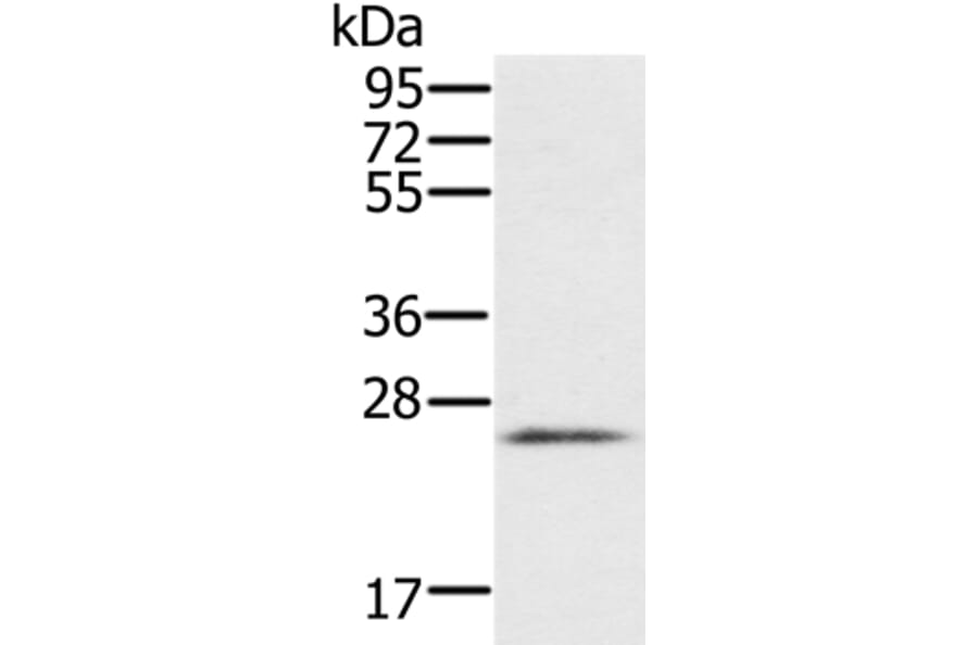 RBM38 Antibody from Signalway Antibody (37864) - Antibodies.com