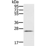 RBM38 Antibody from Signalway Antibody (37864) - Antibodies.com