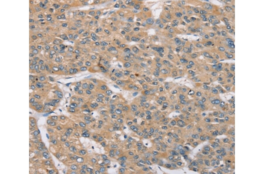 Immunohistochemistry - RBM38 Antibody from Signalway Antibody (37864) - Antibodies.com