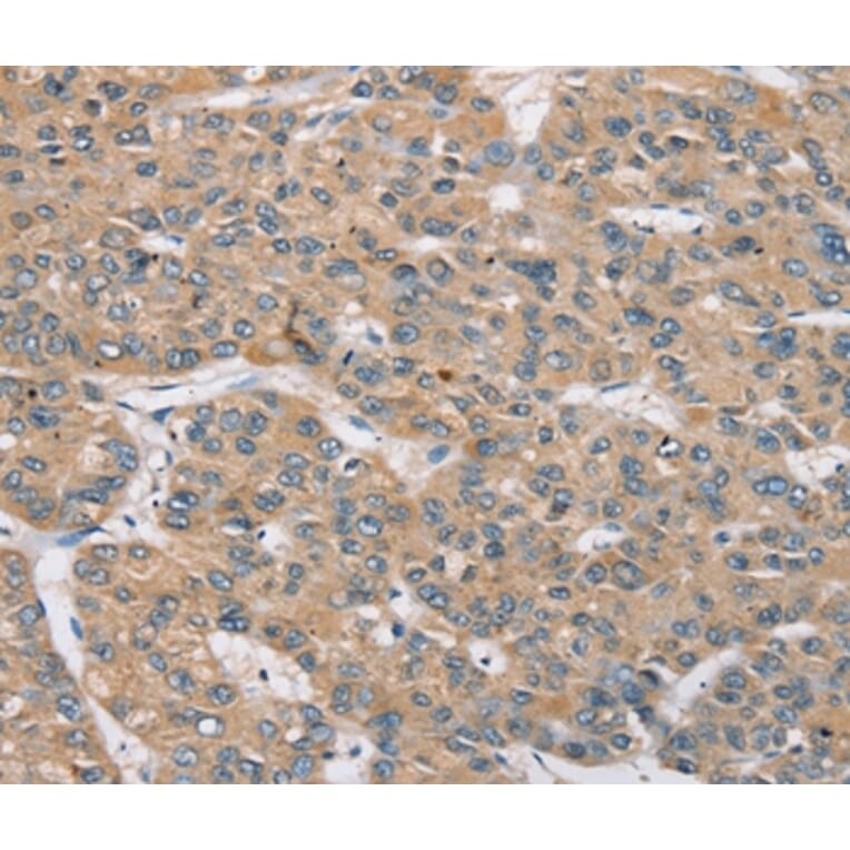 Immunohistochemistry - RBM38 Antibody from Signalway Antibody (37864) - Antibodies.com
