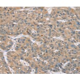 Immunohistochemistry - RBM38 Antibody from Signalway Antibody (37864) - Antibodies.com