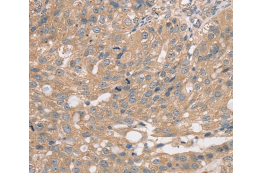 Immunohistochemistry - PRAF2 Antibody from Signalway Antibody (37884) - Antibodies.com
