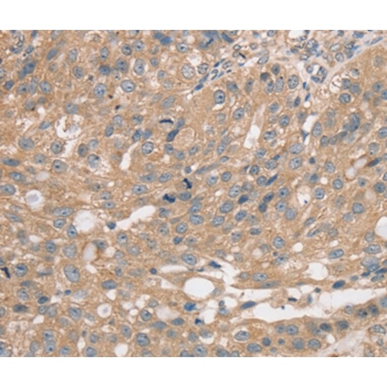 Immunohistochemistry - PRAF2 Antibody from Signalway Antibody (37884) - Antibodies.com