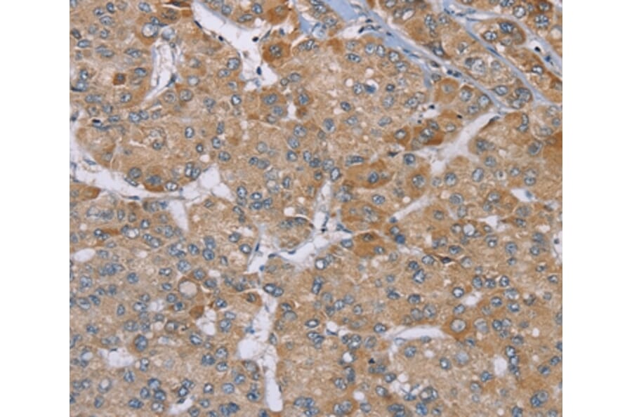 Immunohistochemistry - ACTN2 Antibody from Signalway Antibody (37893) - Antibodies.com