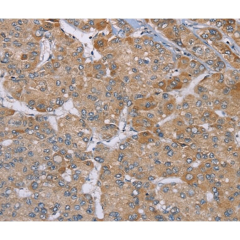 Immunohistochemistry - ACTN2 Antibody from Signalway Antibody (37893) - Antibodies.com