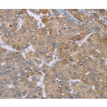 Immunohistochemistry - ACTN2 Antibody from Signalway Antibody (37893) - Antibodies.com