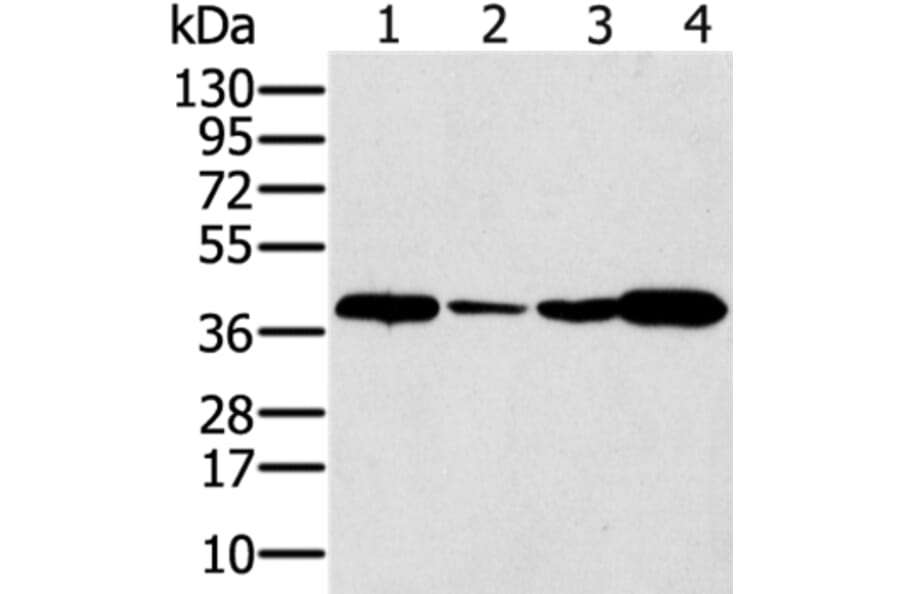 SYCP3 Antibody from Signalway Antibody (37900) - Antibodies.com