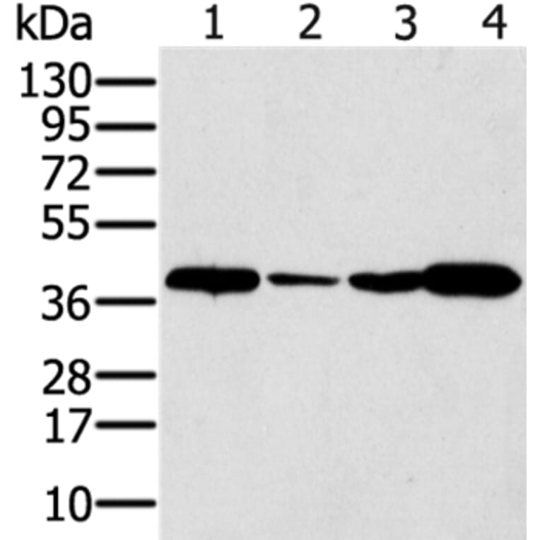 SYCP3 Antibody from Signalway Antibody (37900) - Antibodies.com