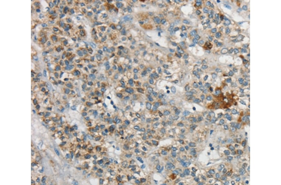 Immunohistochemistry - SYCP3 Antibody from Signalway Antibody (37900) - Antibodies.com