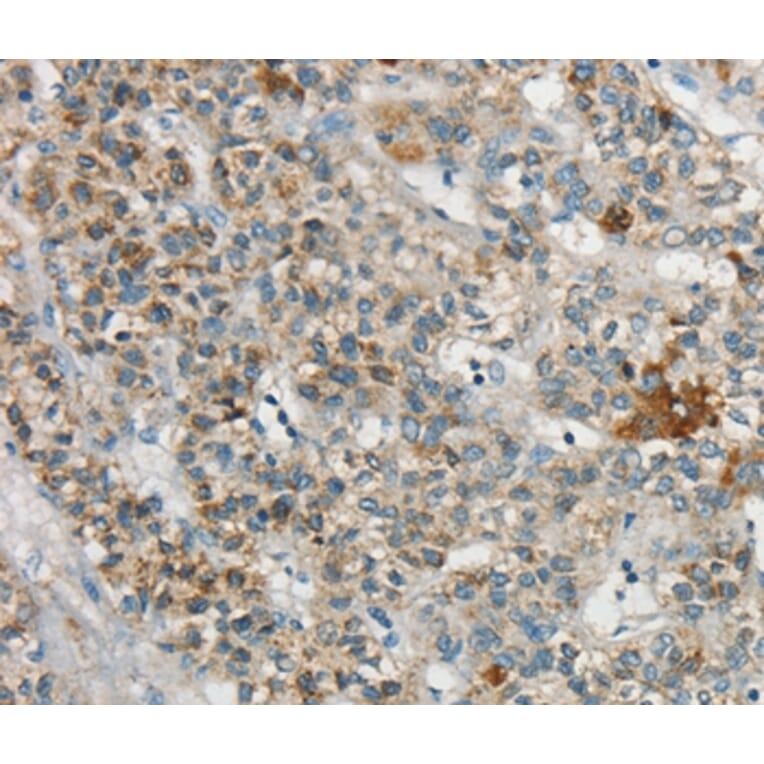 Immunohistochemistry - SYCP3 Antibody from Signalway Antibody (37900) - Antibodies.com