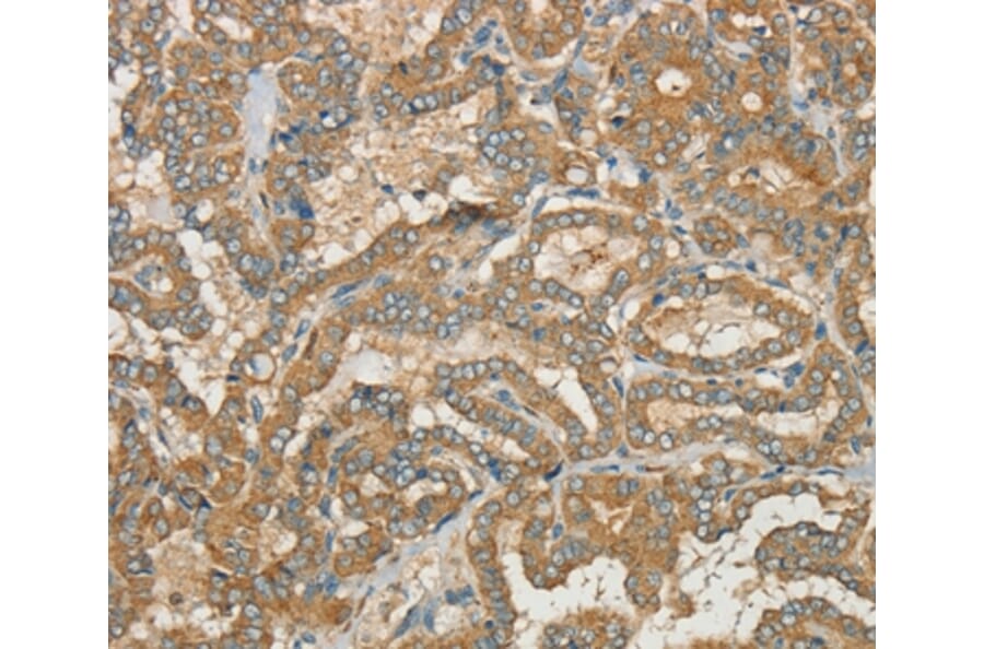 Immunohistochemistry - CWC27 Antibody from Signalway Antibody (37901) - Antibodies.com