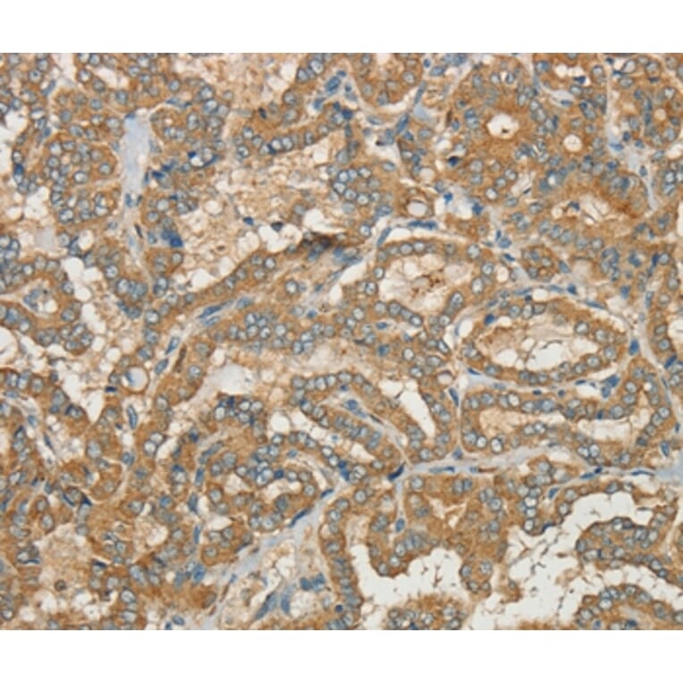 Immunohistochemistry - CWC27 Antibody from Signalway Antibody (37901) - Antibodies.com