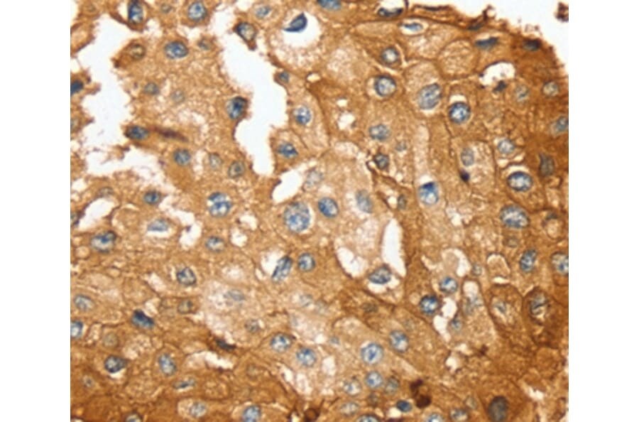 Immunohistochemistry - SESN2 Antibody from Signalway Antibody (37917) - Antibodies.com