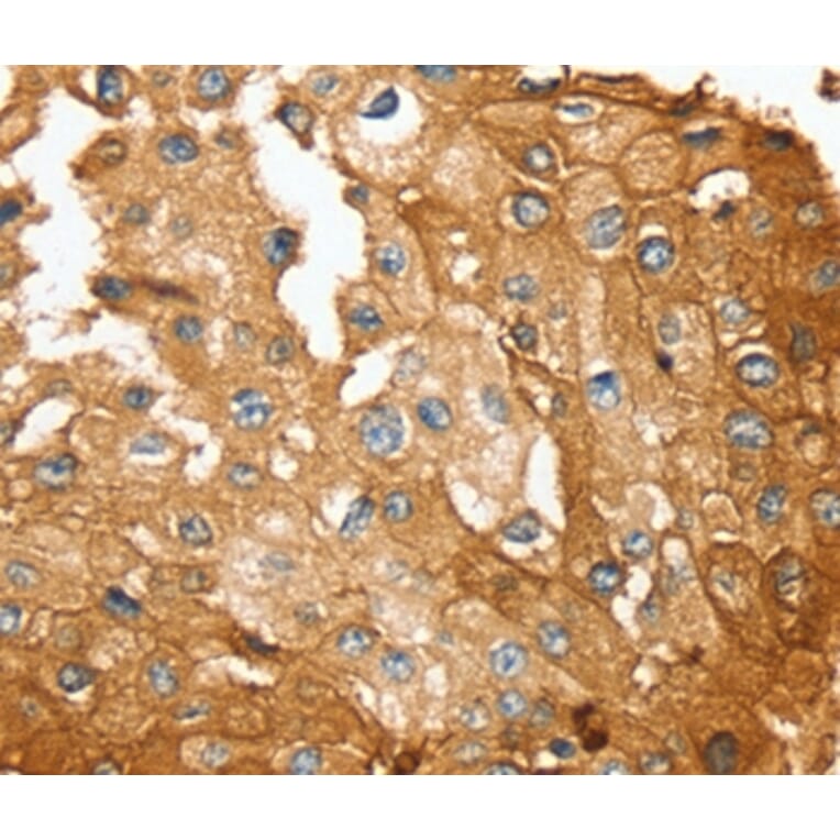 Immunohistochemistry - SESN2 Antibody from Signalway Antibody (37917) - Antibodies.com