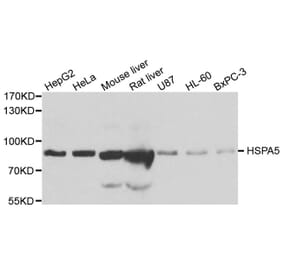 Western blot - HSPA5 antibody from Signalway Antibody (38110) - Antibodies.com