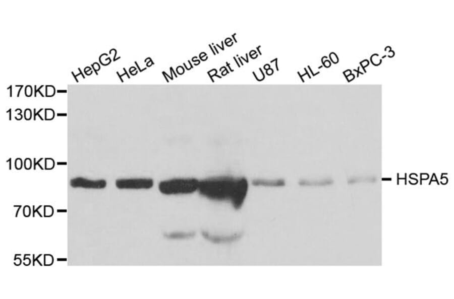 Western blot - HSPA5 antibody from Signalway Antibody (38110) - Antibodies.com