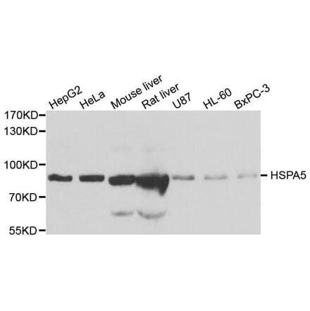 Western blot - HSPA5 antibody from Signalway Antibody (38110) - Antibodies.com