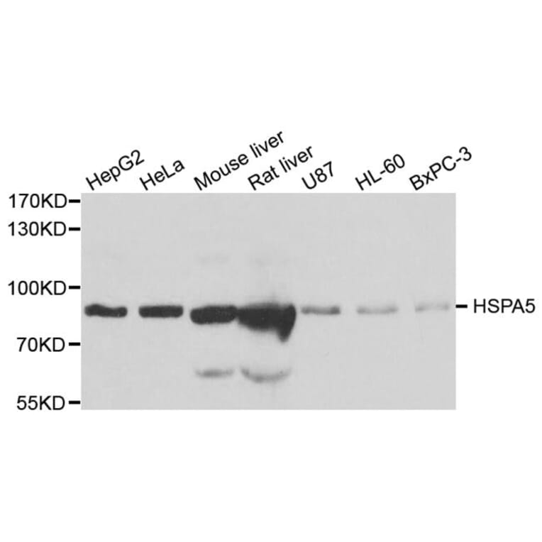 Western blot - HSPA5 antibody from Signalway Antibody (38110) - Antibodies.com