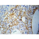 Immunohistochemistry - HSPA5 antibody from Signalway Antibody (38110) - Antibodies.com