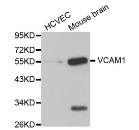 Western blot - VCAM1 antibody from Signalway Antibody (38123) - Antibodies.com