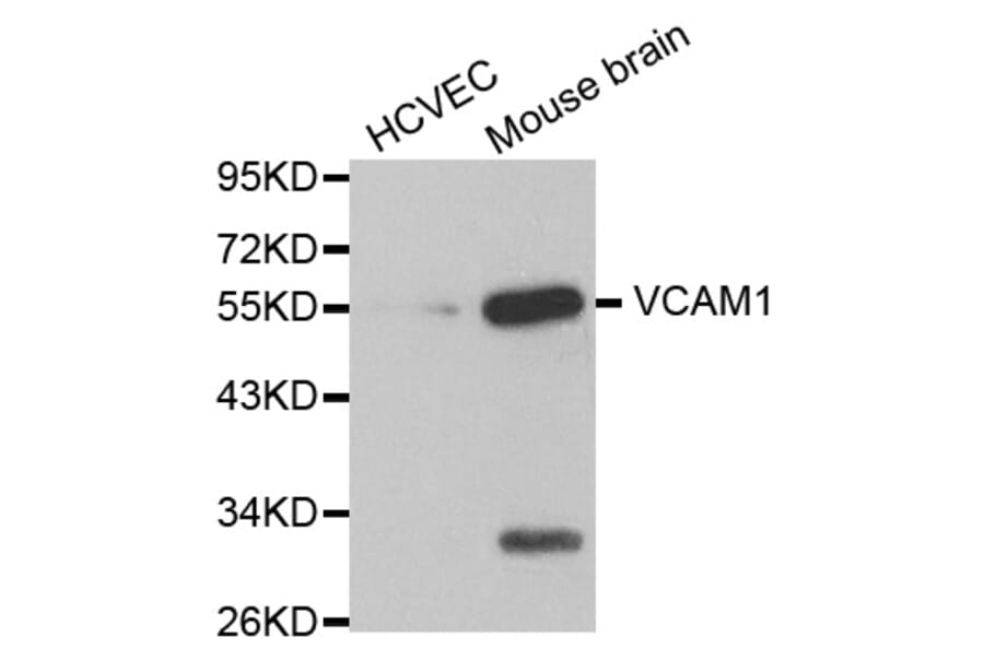 Western blot - VCAM1 antibody from Signalway Antibody (38123) - Antibodies.com