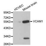 Western blot - VCAM1 antibody from Signalway Antibody (38123) - Antibodies.com