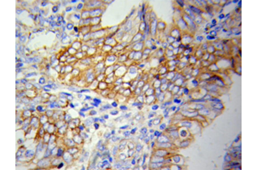 Immunohistochemistry - VCAM1 antibody from Signalway Antibody (38123) - Antibodies.com