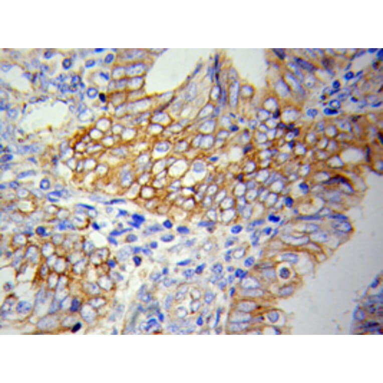 Immunohistochemistry - VCAM1 antibody from Signalway Antibody (38123) - Antibodies.com