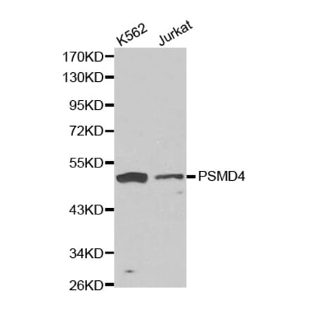 Western blot - PSMD4 antibody from Signalway Antibody (38172) - Antibodies.com