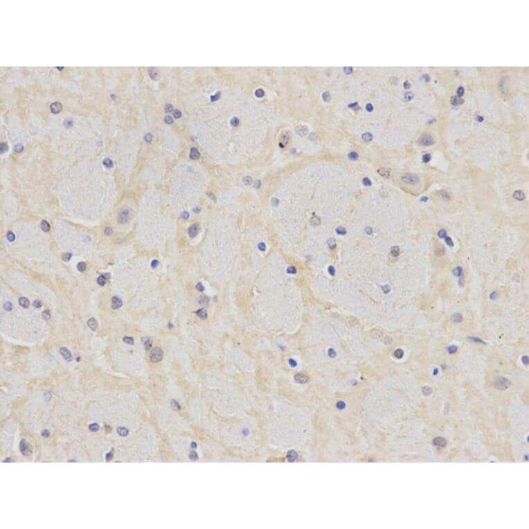 Immunohistochemistry - PSMD4 antibody from Signalway Antibody (38172) - Antibodies.com