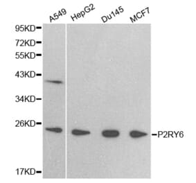 Western blot - P2RY6 antibody from Signalway Antibody (38404) - Antibodies.com