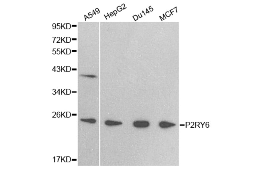 Western blot - P2RY6 antibody from Signalway Antibody (38404) - Antibodies.com