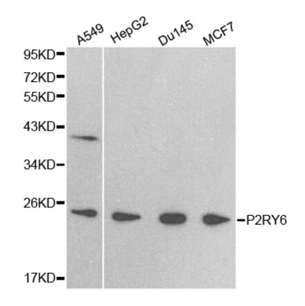 Western blot - P2RY6 antibody from Signalway Antibody (38404) - Antibodies.com