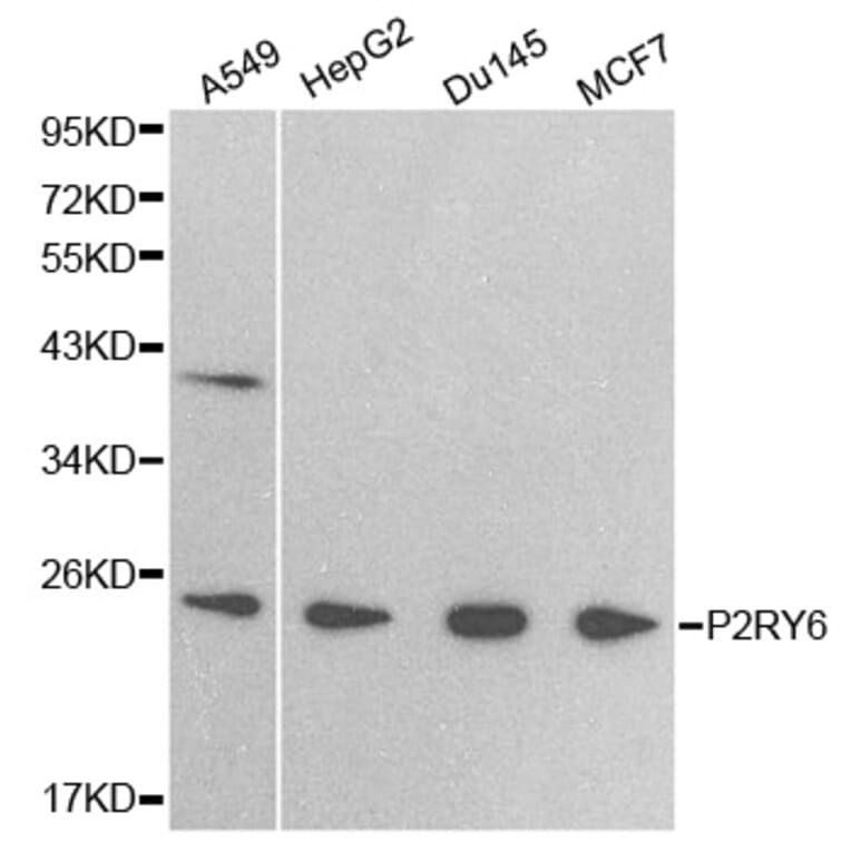 Western blot - P2RY6 antibody from Signalway Antibody (38404) - Antibodies.com