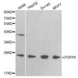 Western blot - P2RY6 antibody from Signalway Antibody (38404) - Antibodies.com