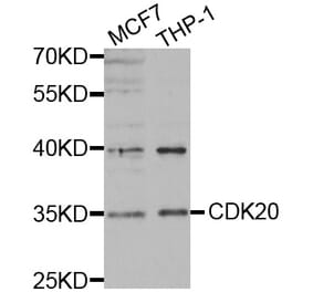 Western blot - CDK20 antibody from Signalway Antibody (38440) - Antibodies.com