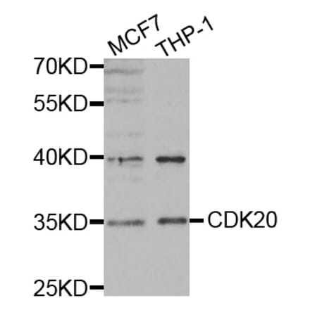 Western blot - CDK20 antibody from Signalway Antibody (38440) - Antibodies.com