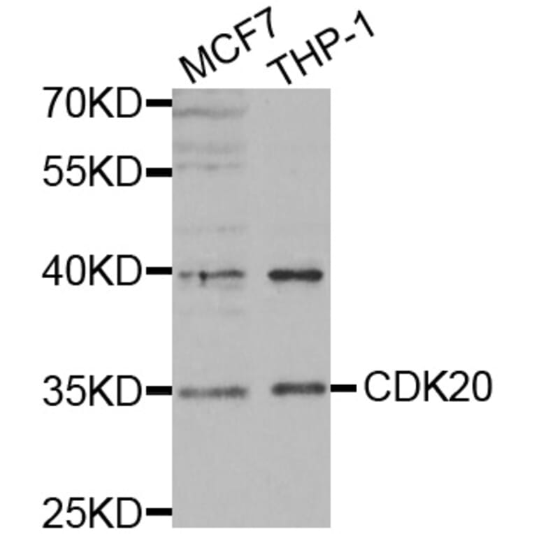 Western blot - CDK20 antibody from Signalway Antibody (38440) - Antibodies.com