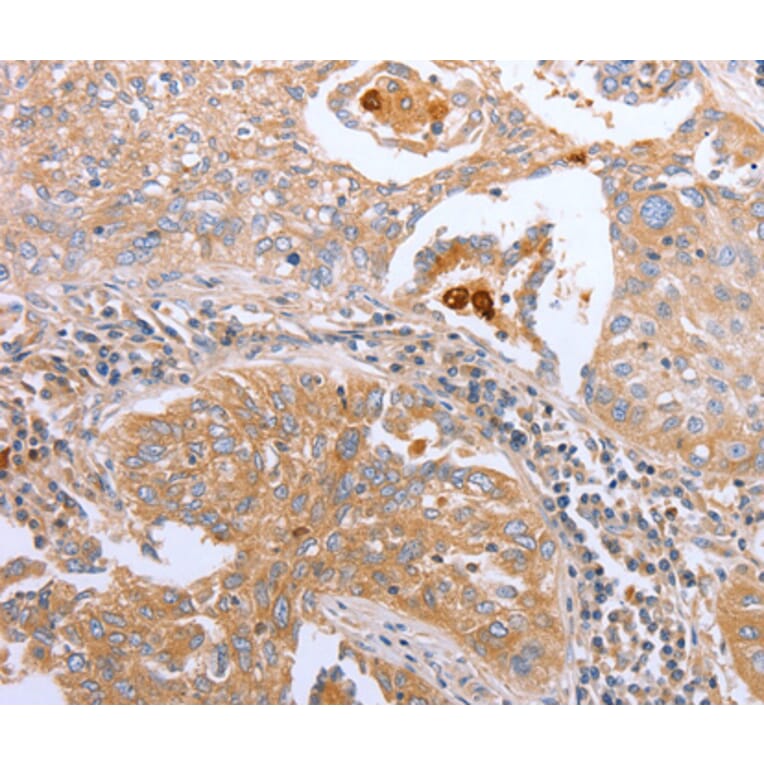 Immunohistochemistry - CDK20 antibody from Signalway Antibody (38440) - Antibodies.com