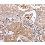 Immunohistochemistry - CDK20 antibody from Signalway Antibody (38440) - Antibodies.com